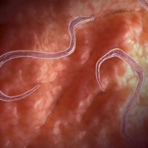 Parasites in the intestines