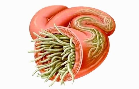 Worms are parasites in the human intestine