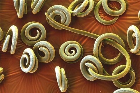 human parasite priquinella