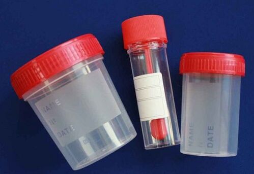 jar for parasite testing