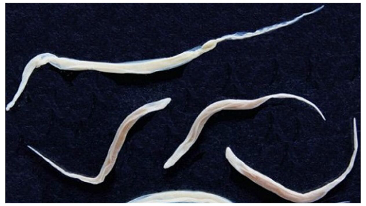 Pinworms are common parasites that belong to the group of helminths.
